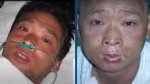 83 Days of Hisashi Ouchi's Suffering Revealed