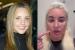 Amanda Bynes Reveals She Had Blepharoplasty Surgery in New Video Hollywood Life ·