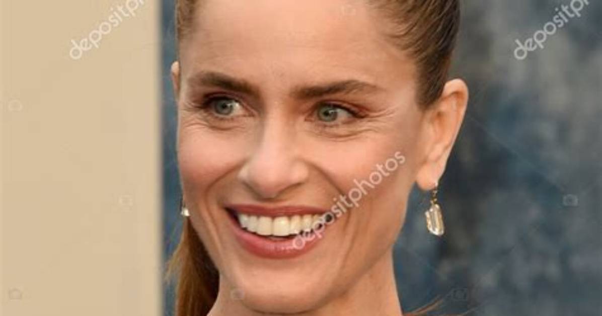 Amanda Peet