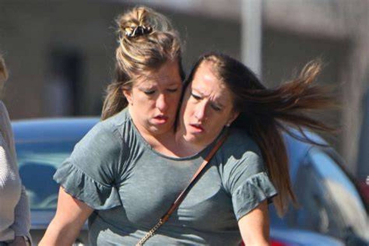 Are Abby and Brittany Still Alive? the Truth Behind the 2024 Rumors
