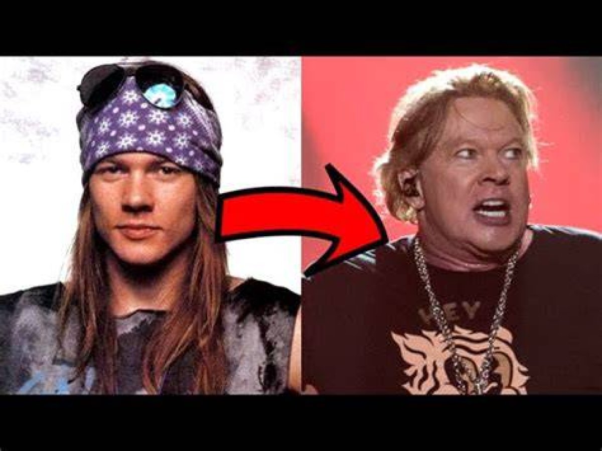 Axel Rose Now: the Evolution of a Rock Legend