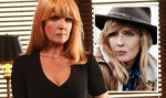 Beth Dutton Lip Injections: Surgery Before and After Photos