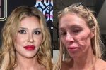 Brandi Glanville in Hospital for Stress-Induced Angioedema After Face Blew up Like a Basketball (Exc