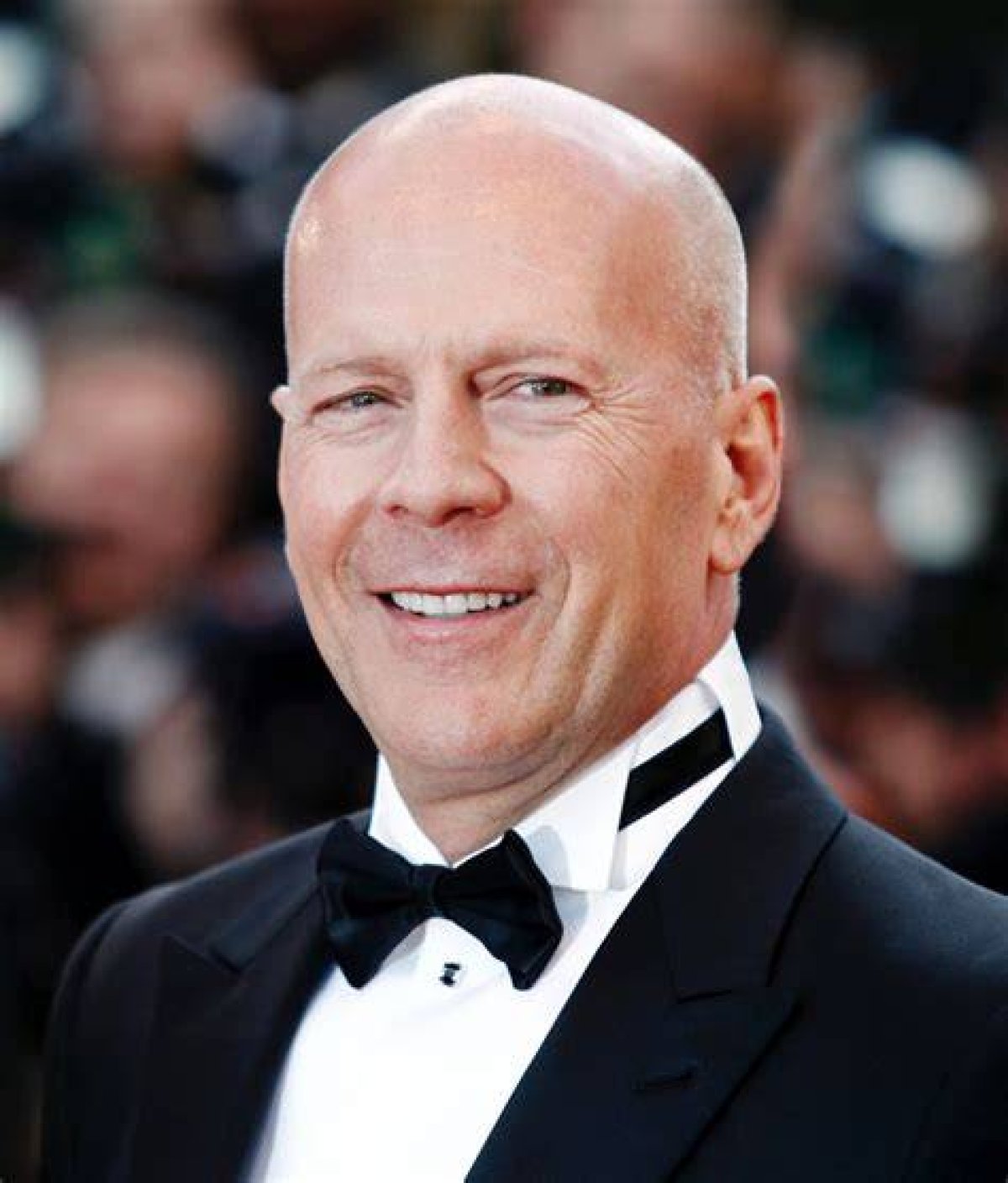 Celebrating the Iconic Bald Famous Actors