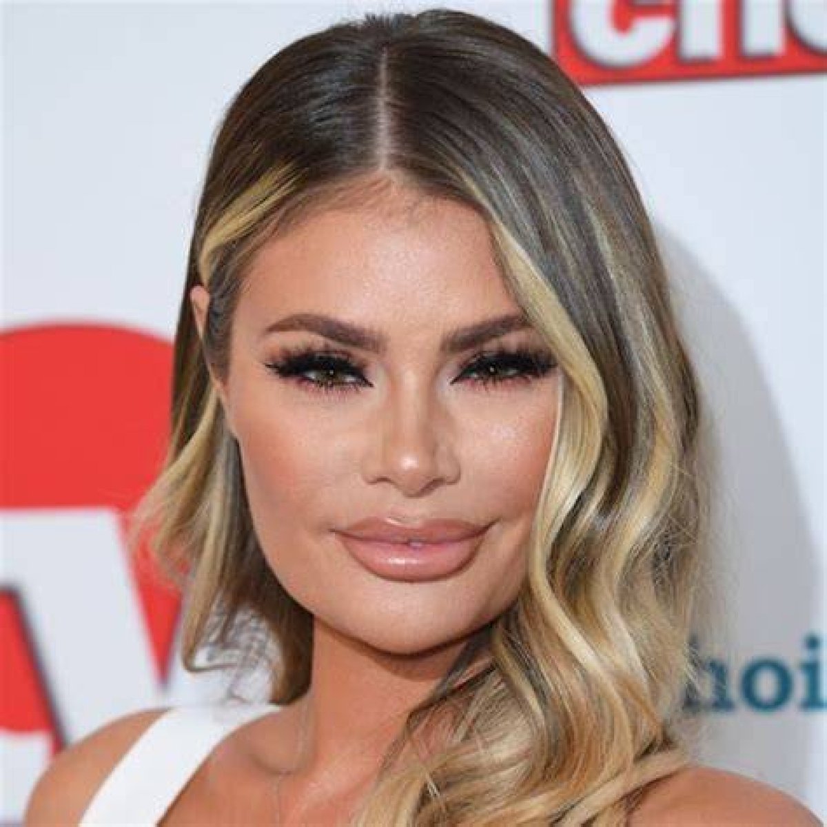 Chloe Sims Shocking Surgery Transformation in Pics See the Towie Star Before and After T ·