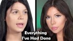 Did Blaire White Have Bottom Surgery? Unpacking the Truth
