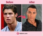 Did He Get Surgery? Before and After Pics, Age and Height |