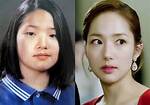Did Park Min Young Have Plastic Surgery? Park Min Young Before and After