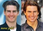 Did Tom Cruise Get a Nose Job?
