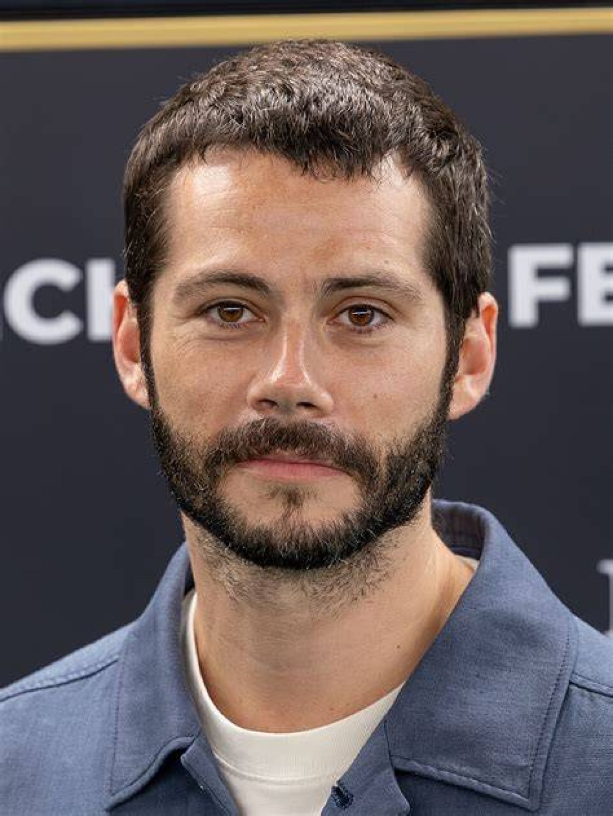 Dylan O'brien Almost Stopped Acting After Maze Runner on Set Accident