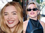 Florence Pugh Lip Filler: the Transformation of a Rising Star