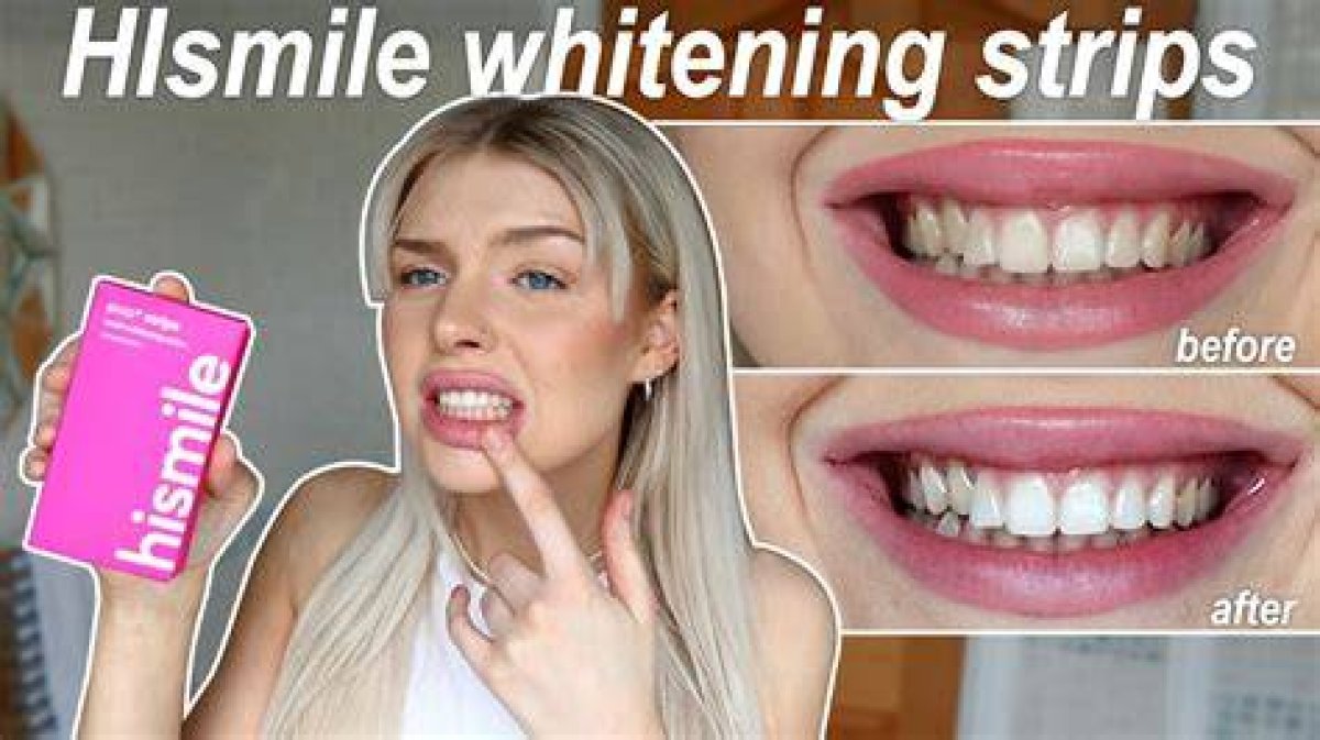 Hismile Reviews: Our Honest Hismile Teeth Whitening Thoughts