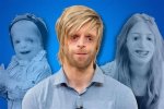 Inspiring Lives: Treacher Collins Syndrome Famous People