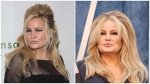Jennifer Coolidge's Plastic Surgery Journey