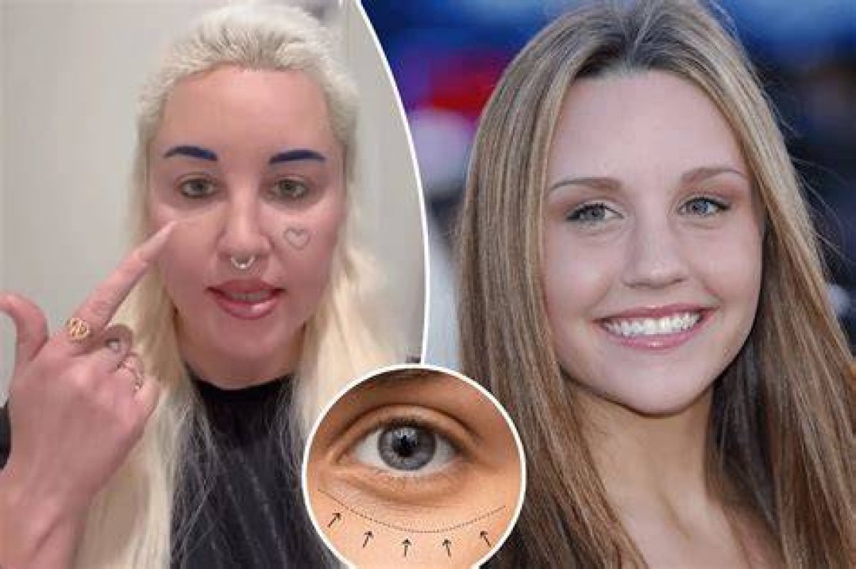 Katherine Langford's Plastic Surgery Journey
