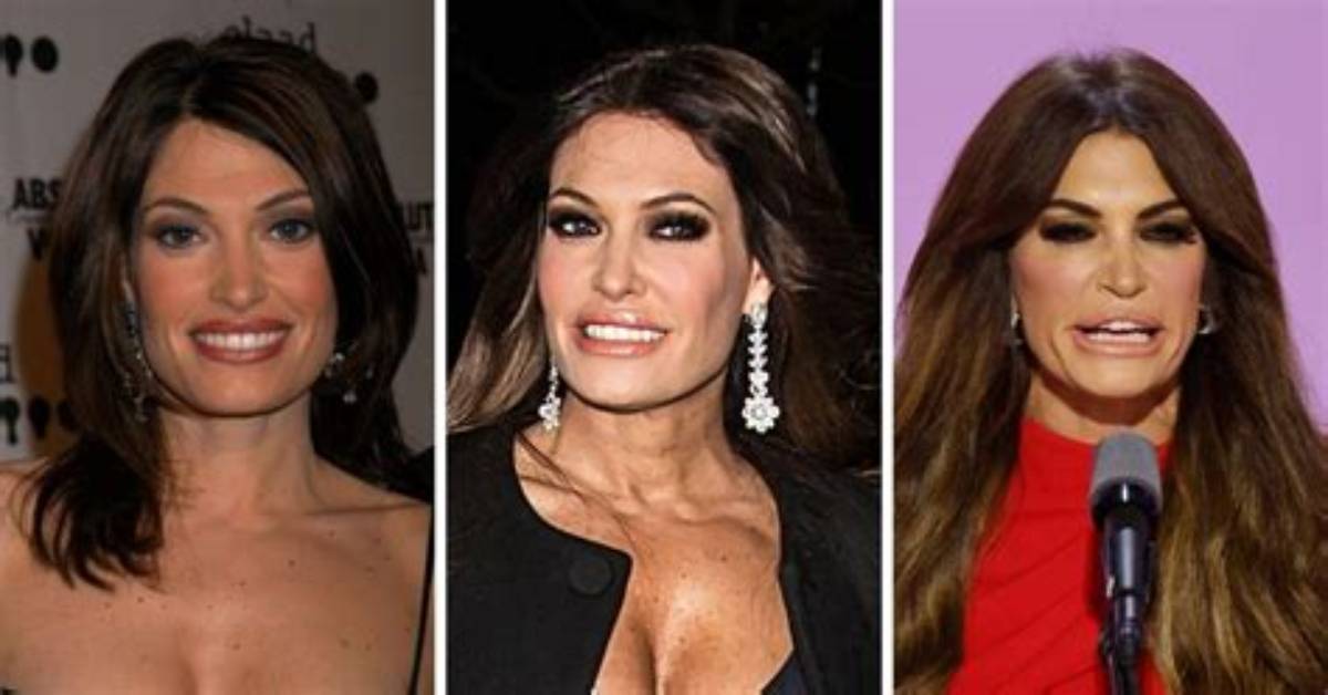 Kimberly Guilfoyle Before and After Pics: a Comprehensive Look at Her Transformation