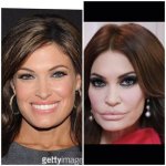 Kimberly Guilfoyle Before Cosmetic Procedures: Dramatic Transformation Revealed