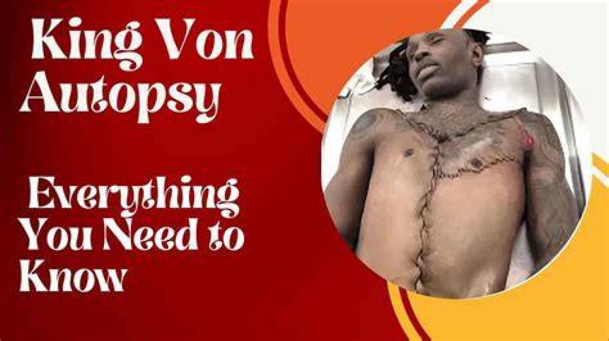 King Von Autopsy Results Revealed: Unveiling the Truth Behind the Tragedy