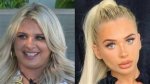 Liberty Love Island: the Transformation Before and After Surgery
