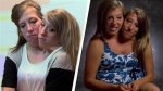 Life’s Twists: the Journey of Conjoined Twins Abby and Brittany Pregnant