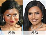 Mindy Kaling Plastic Surgery – Look at Her Before and After Images