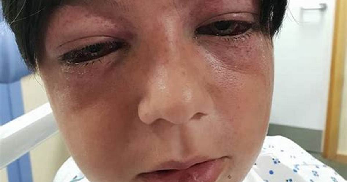 Parents Warned over Dangerous 'Roundabout Challenge' Kids Craze That Can Trigger 'Red-Outs' and Stro |