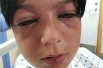 Parents Warned over Dangerous 'Roundabout Challenge' Kids Craze That Can Trigger 'Red-Outs' and Stro |