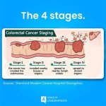 Pioneer Woman Colon Cancer Stage 4: a Comprehensive Guide
