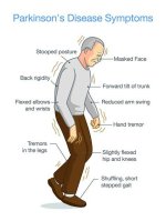 Richard Dreyfuss Parkinson's Disease: Symptoms, Diagnosis, and Treatment