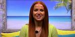 Sydney Love Island Before Surgery
