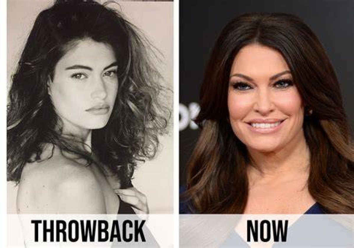 The Perplexing Transformation: Kimberly Guilfoyle's Facial Enigma