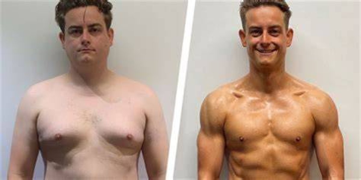 Tommie Before Surgery: a Journey of Transformation