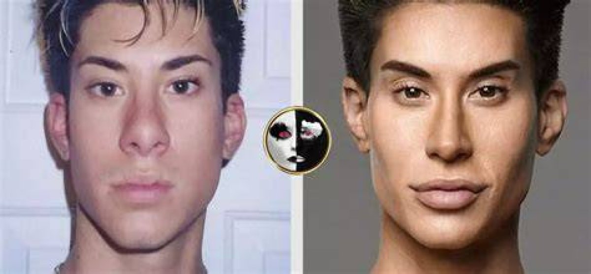 Transforming Beauty: the Journey of Justin Jedlica and His Plastic Surgery