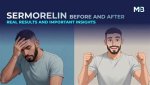 Uncovering Before and After Insights