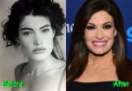 Understanding Kimberly Guilfoyle Before Surgery: a Journey of Transformation
