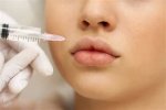 Unlocking the Secrets of Bleach Fillers: a Complete Guide