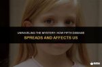 Unraveling the Mystery: What Disease Does Billy Joel Have?