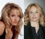 Unveiling Ellen Barkin's Plastic Surgery Journey: Discoveries and Transformations