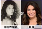 Unveiling Kimberly Guilfoyle: the Transformation Before and After