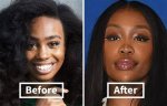 Unveiling Sza's Pre-Surgery Transformation: a Comprehensive Guide