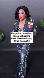 Unveiling the "Morphine Love Dion Age": Discoveries and Insights