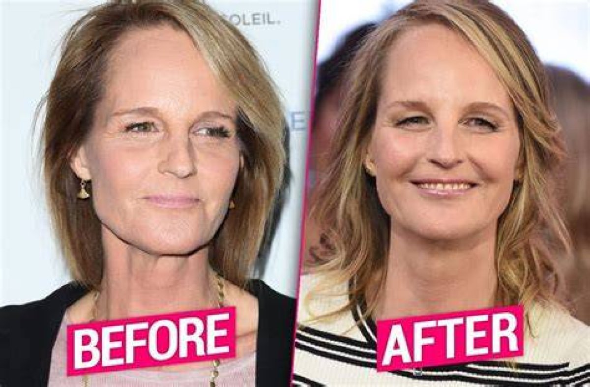 Unveiling the Secrets: Helen Hunt's Transformation