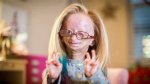 Unveiling the Story: What Did Adalia Rose Have?
