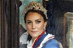Unveiling the Truth About Princess Kate's Hysterectomy: a Journey of Discovery