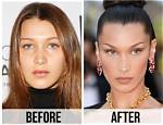 Unveiling the Truth Behind Bella Hadid's Plastic Surgery Rumors