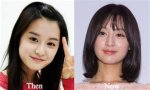 Unveiling the Truth Behind Kim Ji Won Plastic Surgery
