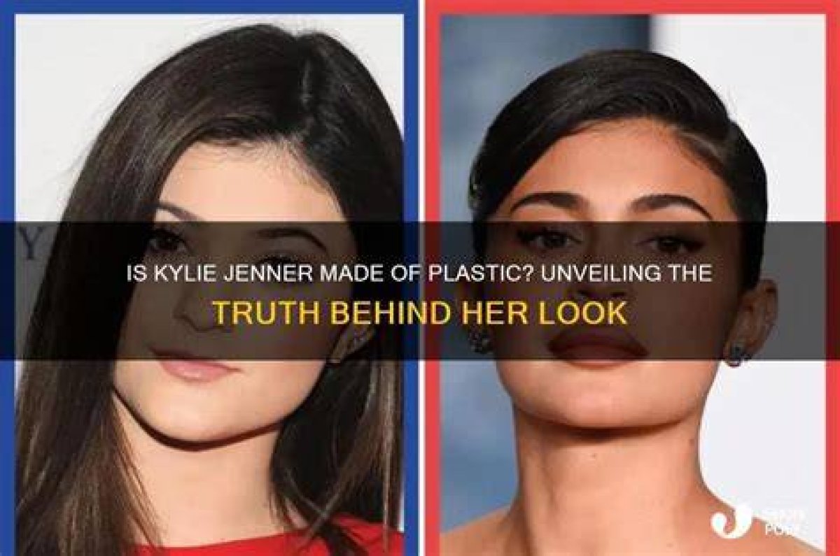 Unveiling the Truth Behind Kylie Jenner's Botox Migration: Discoveries and Insights