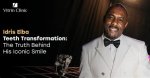 Why Is Idris Elba Teeth So White? Fans Suspect Dental Surgery or Fake Tooth